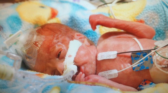 Born at 23 weeks, this micropreemie is sharing the truth about abortion